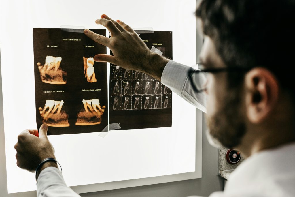 Tandläkare analyserar tandröntgen för att upptäcka karies och andra problem